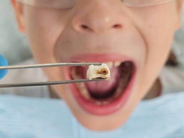 Best Walk-In Emergency Dental Services in Oak Hill, TN